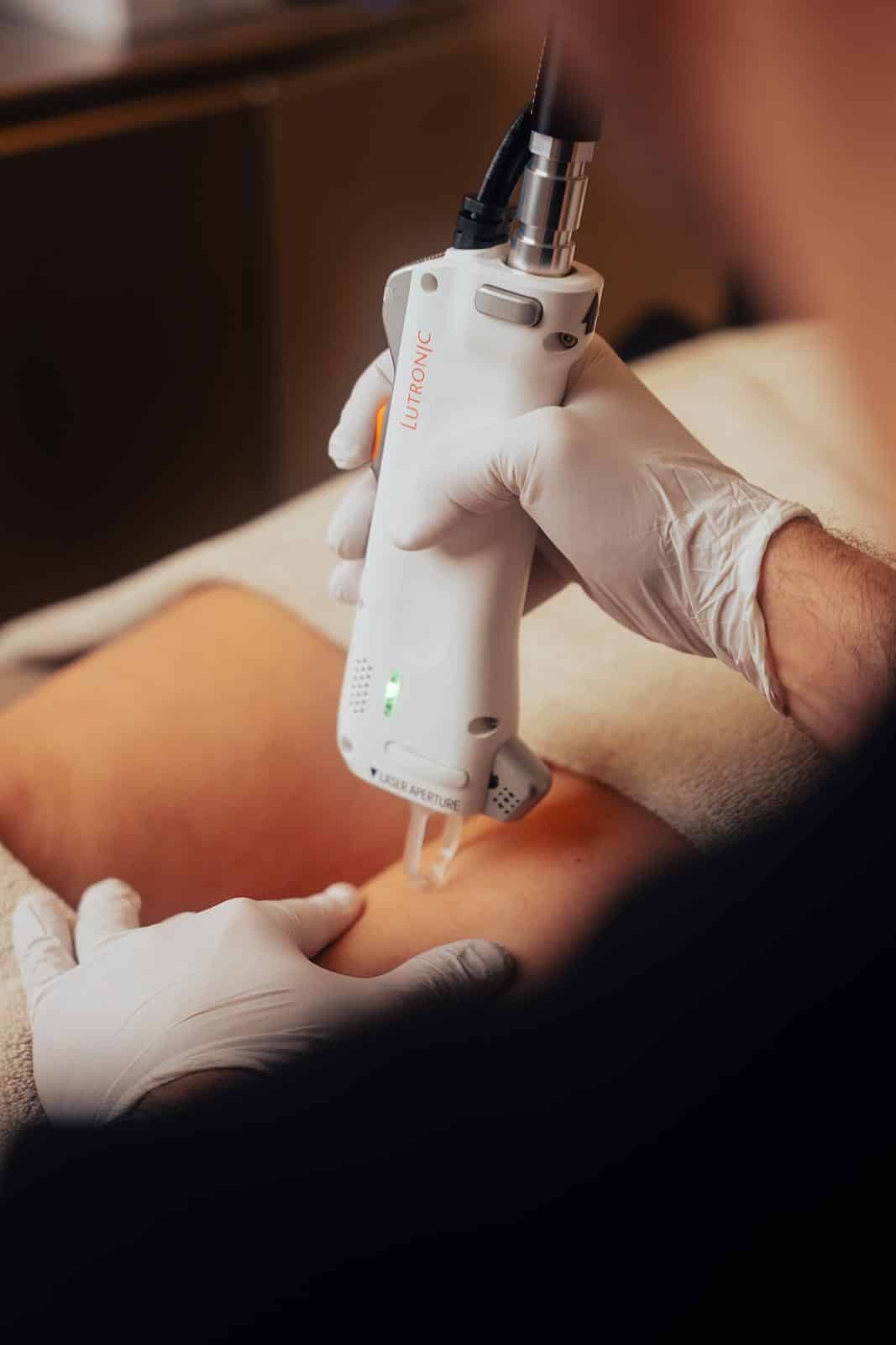 Profesjonell laser hårfjerning hos Klinikk Skien – Effektiv og skånsom behandling for ansikt, bikinilinje, armer og ben. Bli kvitt uønsket hår permanent!