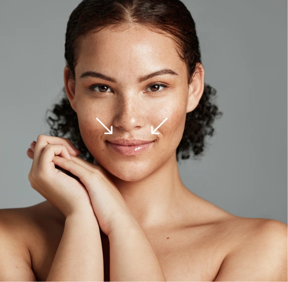 Filler i leppene hos Klinikk Skien gir naturlig volum og form.